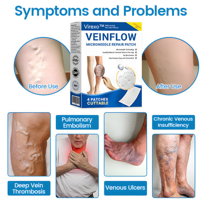 Virexo™ Microneedle Patch – FDA-Approved Varicose Vein Treatment