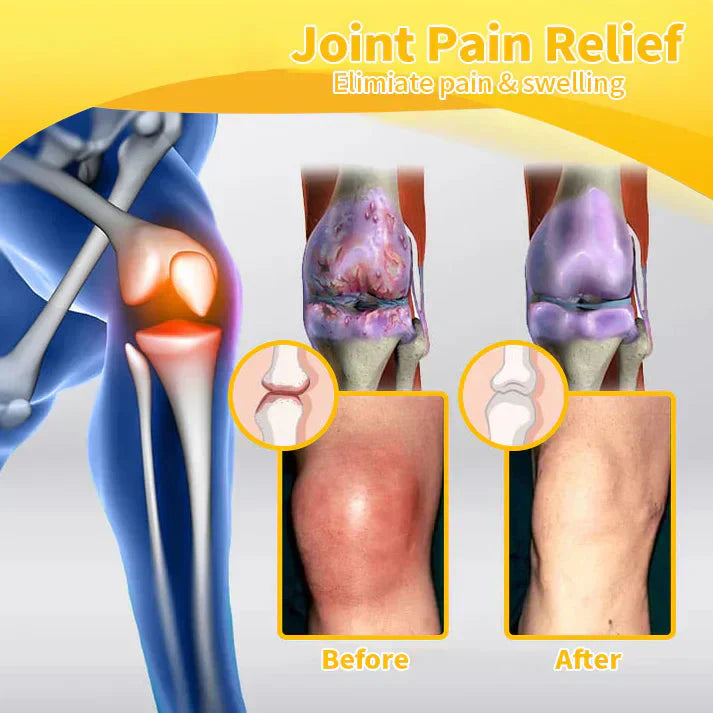 ✅Official Store: LUMIVO™ Bee-Venom Pain-Relief Bone Healing Cream👨‍⚕️USA Osteopathic Medical Association （AAOS）Approved(Reducing joint swelling, pain, stiffness, redness, warmth, soreness, and joint fatigue)