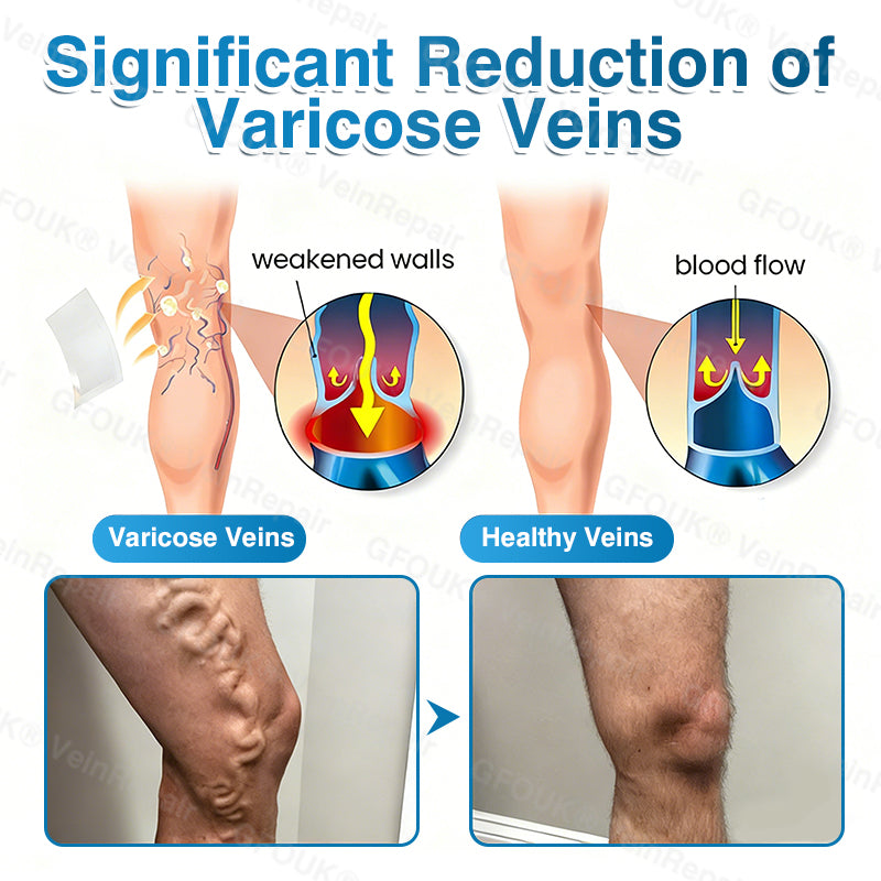 🇺🇸🏆✅️🏃LUMIVO™VeinRepair Microneedle Patch Roll⚡Instant Relief, Long-Term Results