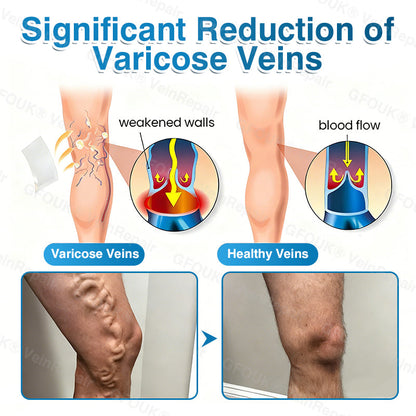 🇺🇸🏆✅️🏃LUMIVO™VeinRepair Microneedle Patch Roll⚡Instant Relief, Long-Term Results