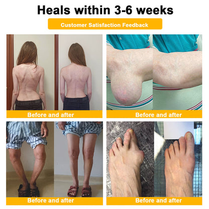 ⏰FLASH SALE: 59% OFF🔥LUMIVO™ Botulinum Toxin & Bee Venom Pain-Relief Bone Healing Cream