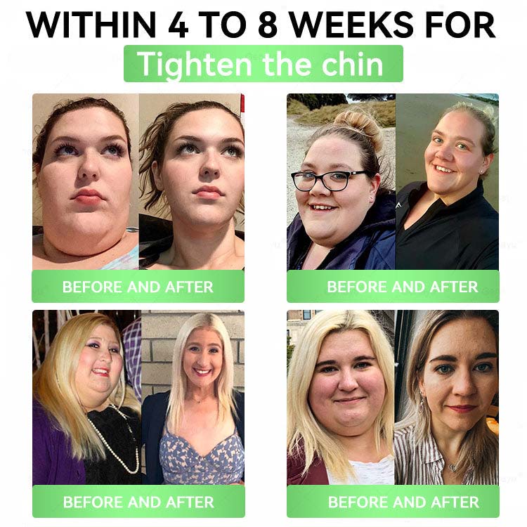 Official Store| Alcuras™ Moringa × Berberine × AMPK 8-Benefit Slimming & Metabolic Nano Microneedle Patch 🇺🇸  Just once a day · Visible changes in 7 days  ✅ For obesity, loose skin, diabetes, sleep apnea, joint issues, and more