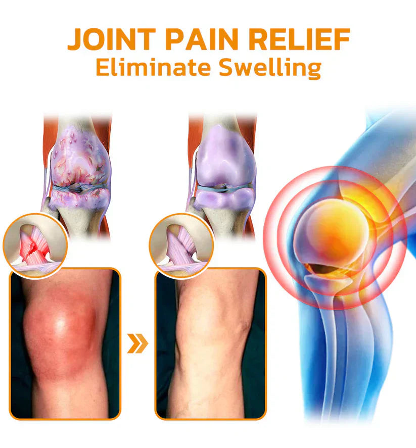 ✅Official Store: LUMIVO™ Bee-Venom Pain-Relief Bone Healing Cream👨‍⚕️USA Osteopathic Medical Association （AAOS）Approved(Reducing joint swelling, pain, stiffness, redness, warmth, soreness, and joint fatigue)