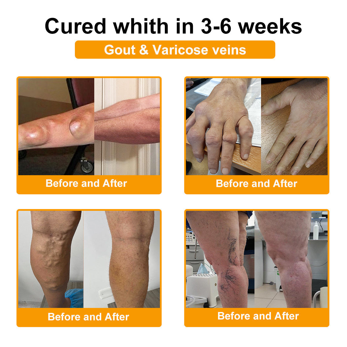⏰FLASH SALE: 59% OFF🔥LUMIVO™ Botulinum Toxin & Bee Venom Pain-Relief Bone Healing Cream