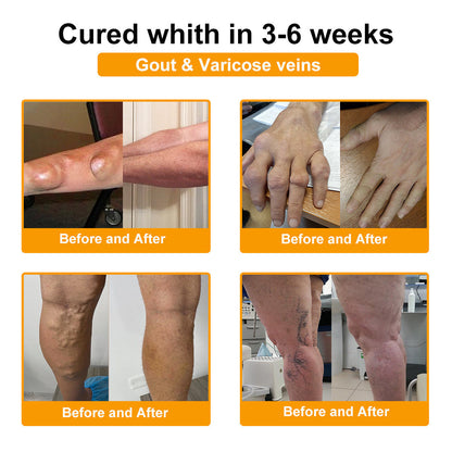 ⏰FLASH SALE: 59% OFF🔥LUMIVO™ Botulinum Toxin & Bee Venom Pain-Relief Bone Healing Cream