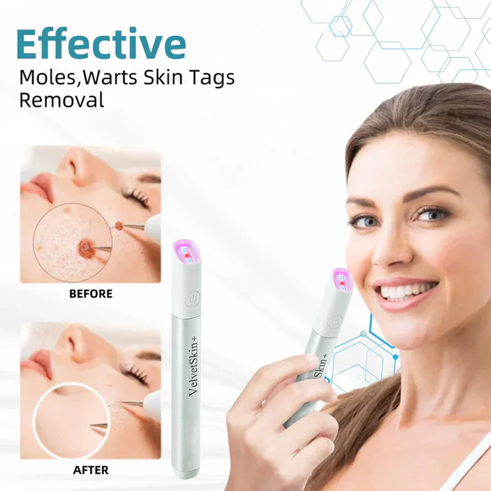 Oceahade™ All-in-One CO₂ Laser Eraser Pen | Removes Moles, Warts, Skin Flaws & Pigmentation