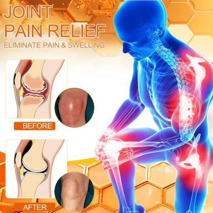 ✅Official Store: LUMIVO™ Bee-Venom Pain-Relief Bone Healing Cream👨‍⚕️USA Osteopathic Medical Association （AAOS）Approved(Reducing joint swelling, pain, stiffness, redness, warmth, soreness, and joint fatigue)