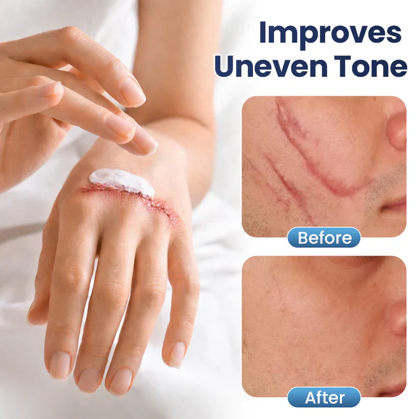 CLINCLII® Texture Repair Gel