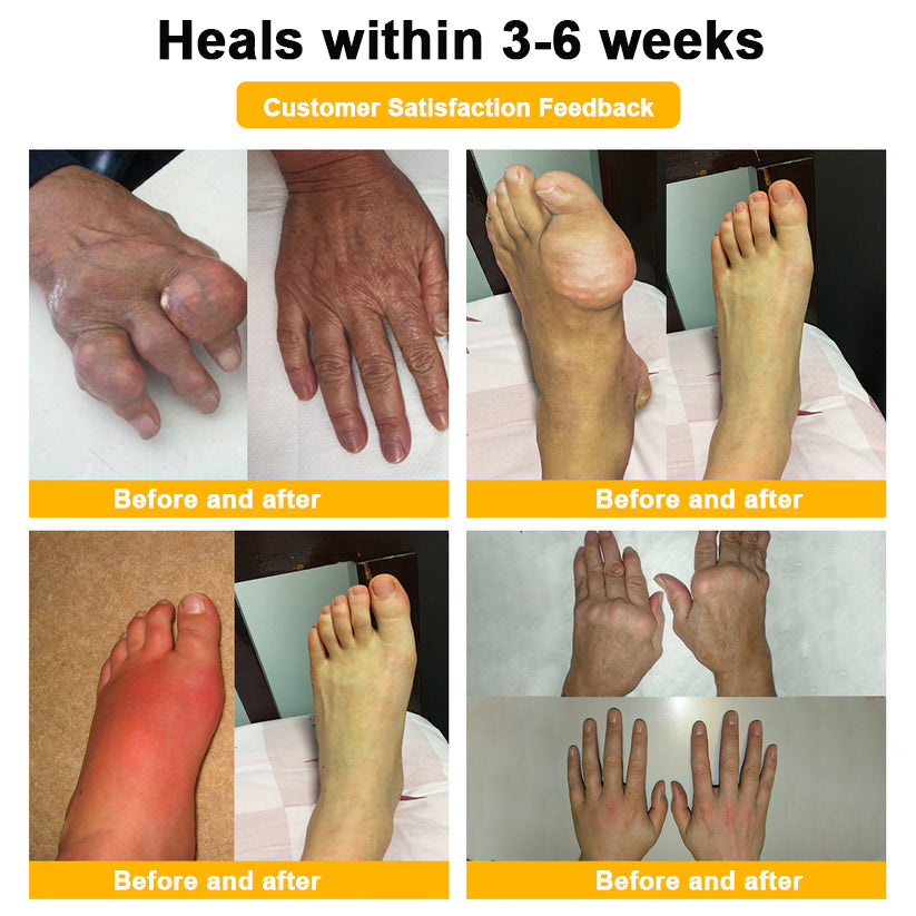 ⏰FLASH SALE: 59% OFF🔥LUMIVO™ Botulinum Toxin & Bee Venom Pain-Relief Bone Healing Cream