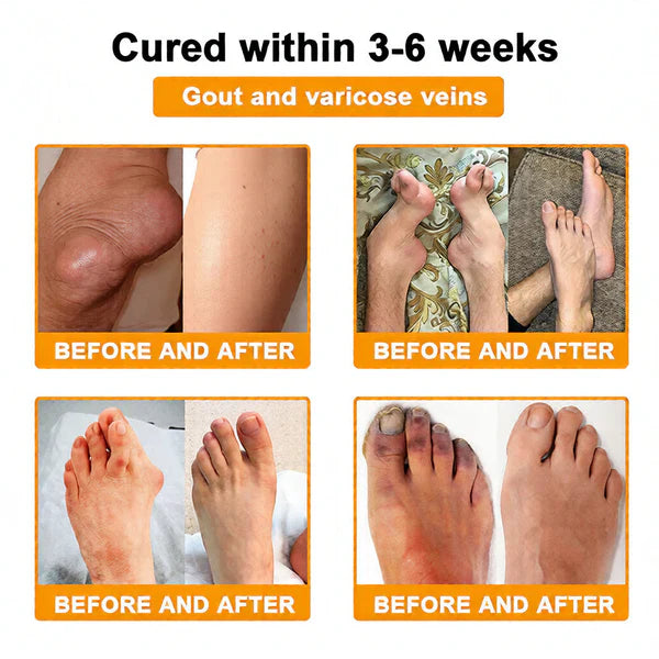 🏆50K+ SOLD LAST WEEK! 🌿LUMIVO™Bee Poison Pain-Relief Bone Healing Cream -8JX3
