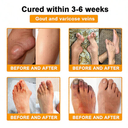 🏆50K+ SOLD LAST WEEK! 🌿LUMIVO™Bee Poison Pain-Relief Bone Healing Cream -8JX3