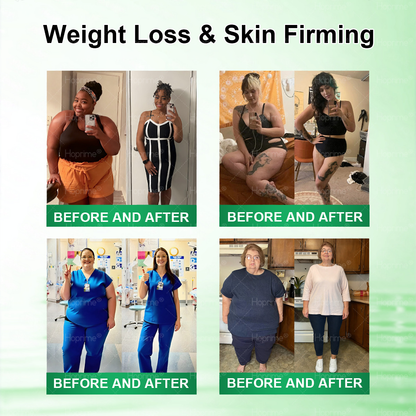 𝐏𝐡𝐲𝐬𝐢𝐜𝐢𝐚𝐧-𝐅𝐨𝐫𝐦𝐮𝐥𝐚𝐭𝐞𝐝 🧑‍⚕️| Hoprime® Moringa · Berberine × AMPK+ 10-in-1 Metabolic Support Nano Microneedle Patch — ✅ 𝐄𝐱𝐩𝐞𝐫𝐢𝐞𝐧𝐜𝐞 𝐕𝐢𝐬𝐢𝐛𝐥𝐞 𝟕-𝐃𝐚𝐲 𝐑𝐞𝐬𝐮𝐥𝐭𝐬 🍇