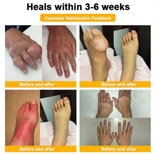 🏆50K+ SOLD LAST WEEK! 🌿LUMIVO™Bee Poison Pain-Relief Bone Healing Cream -8JX3
