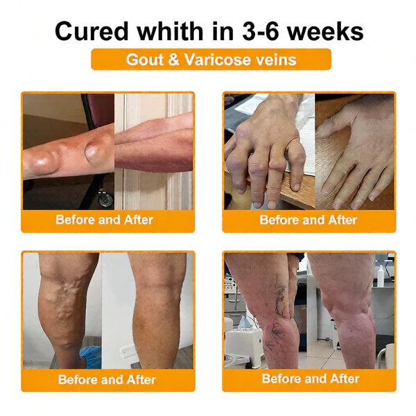🏆50K+ SOLD LAST WEEK! 🌿LUMIVO™Bee Poison Pain-Relief Bone Healing Cream -8JX3