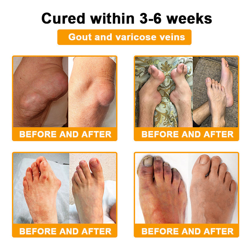 ⏰FLASH SALE: 59% OFF🔥LUMIVO™ Botulinum Toxin & Bee Venom Pain-Relief Bone Healing Cream