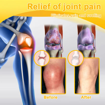 ⏰FLASH SALE: 59% OFF🔥LUMIVO™ Botulinum Toxin & Bee Venom Pain-Relief Bone Healing Cream