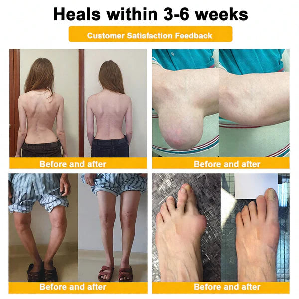 🏆50K+ SOLD LAST WEEK! 🌿LUMIVO™Bee Poison Pain-Relief Bone Healing Cream -8JX3