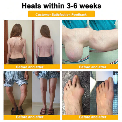 🏆50K+ SOLD LAST WEEK! 🌿LUMIVO™Bee Poison Pain-Relief Bone Healing Cream -8JX3