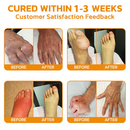 ✅Official Store: LUMIVO™ Bee-Venom Pain-Relief Bone Healing Cream👨‍⚕️USA Osteopathic Medical Association （AAOS）Approved(Reducing joint swelling, pain, stiffness, redness, warmth, soreness, and joint fatigue)