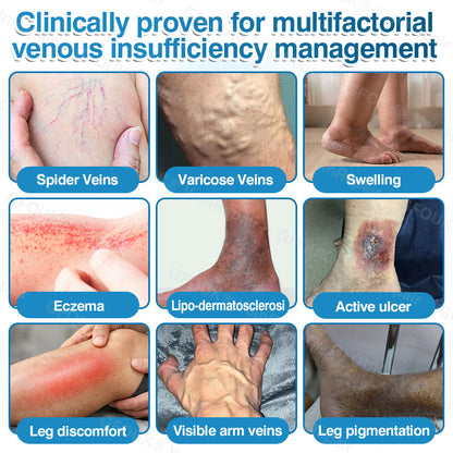 🇺🇸🏆✅️🏃LUMIVO™VeinRepair Microneedle Patch Roll⚡Instant Relief, Long-Term Results