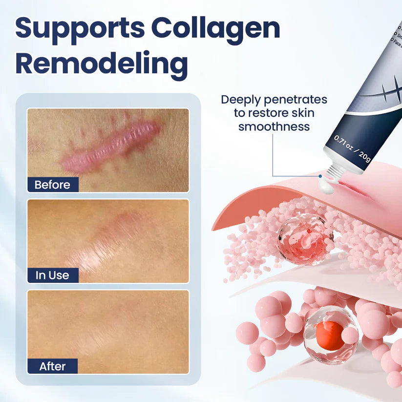 CLINCLII® Texture Repair Gel