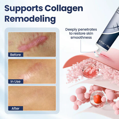 CLINCLII® Texture Repair Gel