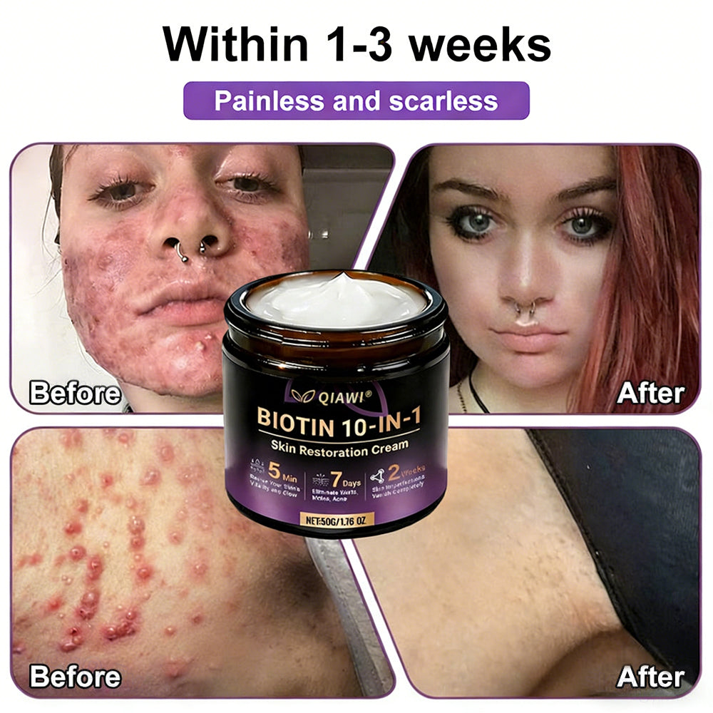 ✨Made and Shipped from USA ✨QIAWI® Biotin 10-in-1 Skin Restoration Cream 🍀